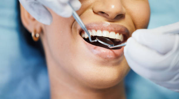 Best Emergency Dental Filling Replacement  in Grandview, OH